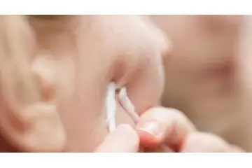 Kulak Arkasında Yağ Bezesi Belirtileri ve Tedavisi